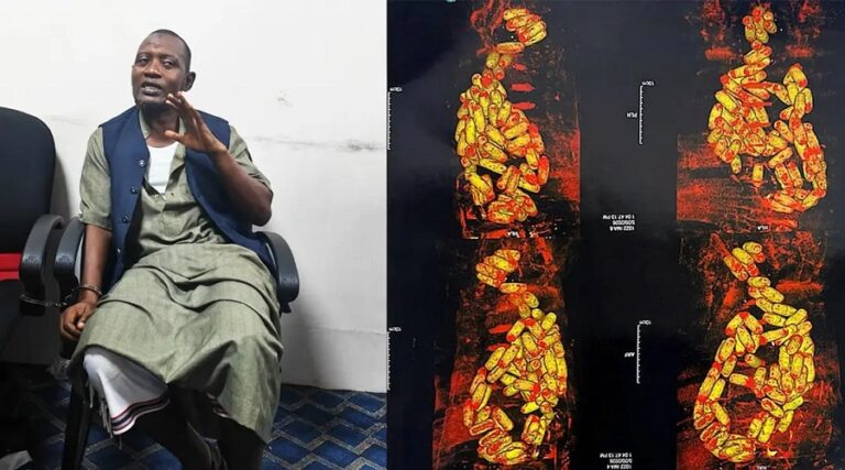 বিমানবন্দরে বিদেশি নাগরিক আটক, পাকস্থলীতে মিলল ৮০ ক্যাপসুল কোকেন
